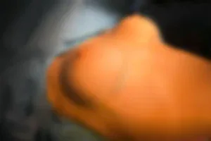 Doğal görünümlü göğüs