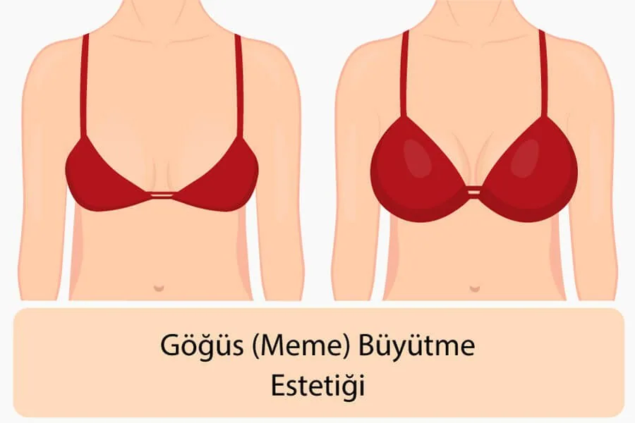 İstanbul Plastik ve Estetik Cerrahı (Doktoru) - Doç. Dr. Çiğdem Karadağ Göğüs (Meme) Büyütme Estetiği Cerrahı (Doktoru) | Doç. Dr. Çiğdem Karadağ