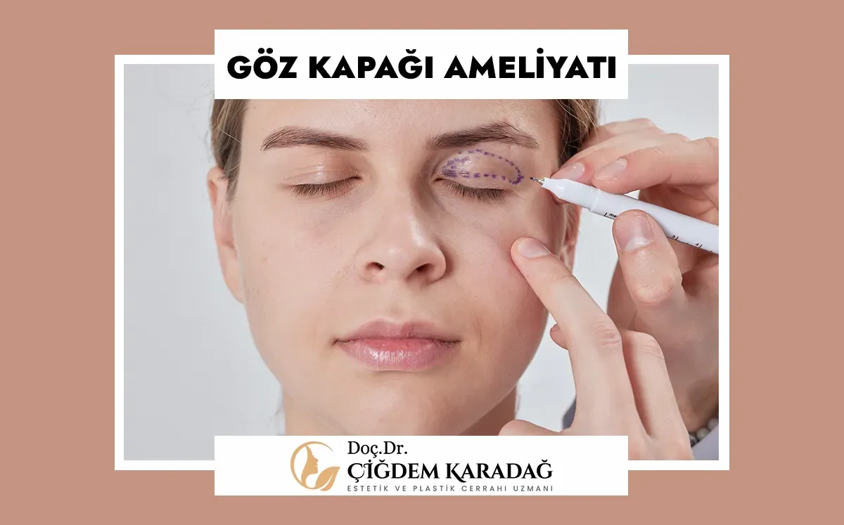 Göz Kapağı Ameliyatı Hakkında Bilmeniz Gerekenler - Doç. Dr. Çiğdem Karadağ Göz Kapağı Hakkında Bilmeniz Gerekenler