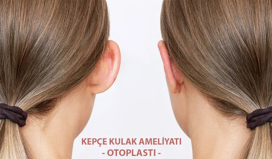 Kepçe Kulak Ameliyatı (Otoplasti) Hakkında - Doç. Dr. Çiğdem Karadağ Kepçe Kulak Ameliyatı (Otoplasti) | İstanbul Estetik Doktoru