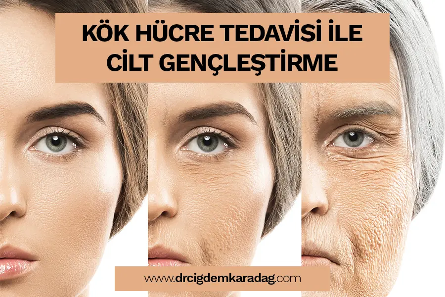 Kök Hücre Tedavisi ile Cilt Gençleştirme İşlemi