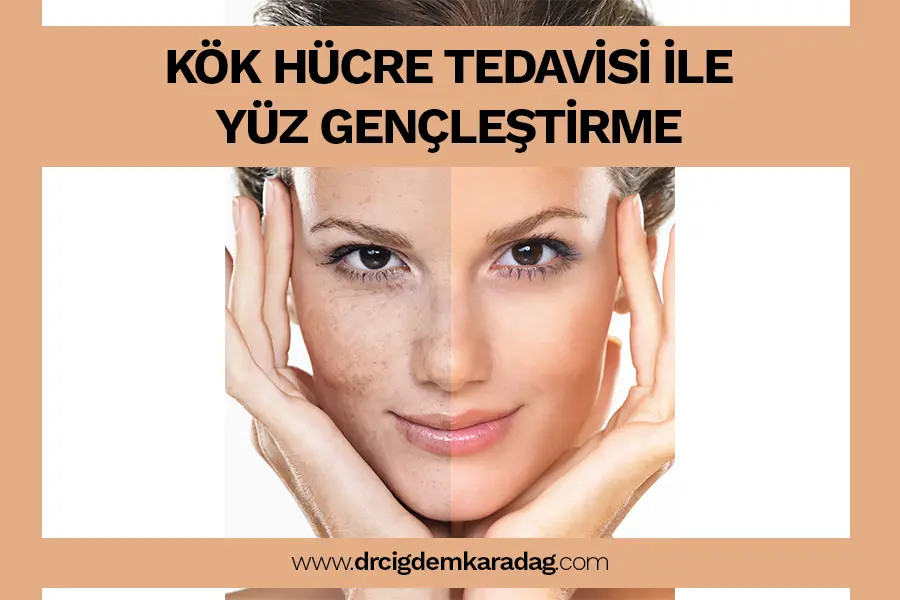 Kök Hücre Tedavisi: Cilt Gençleştirme - Doç. Dr. Çiğdem Karadağ Kök Hücre Tedavisi ile Yüz Gençleştirme İşlemi