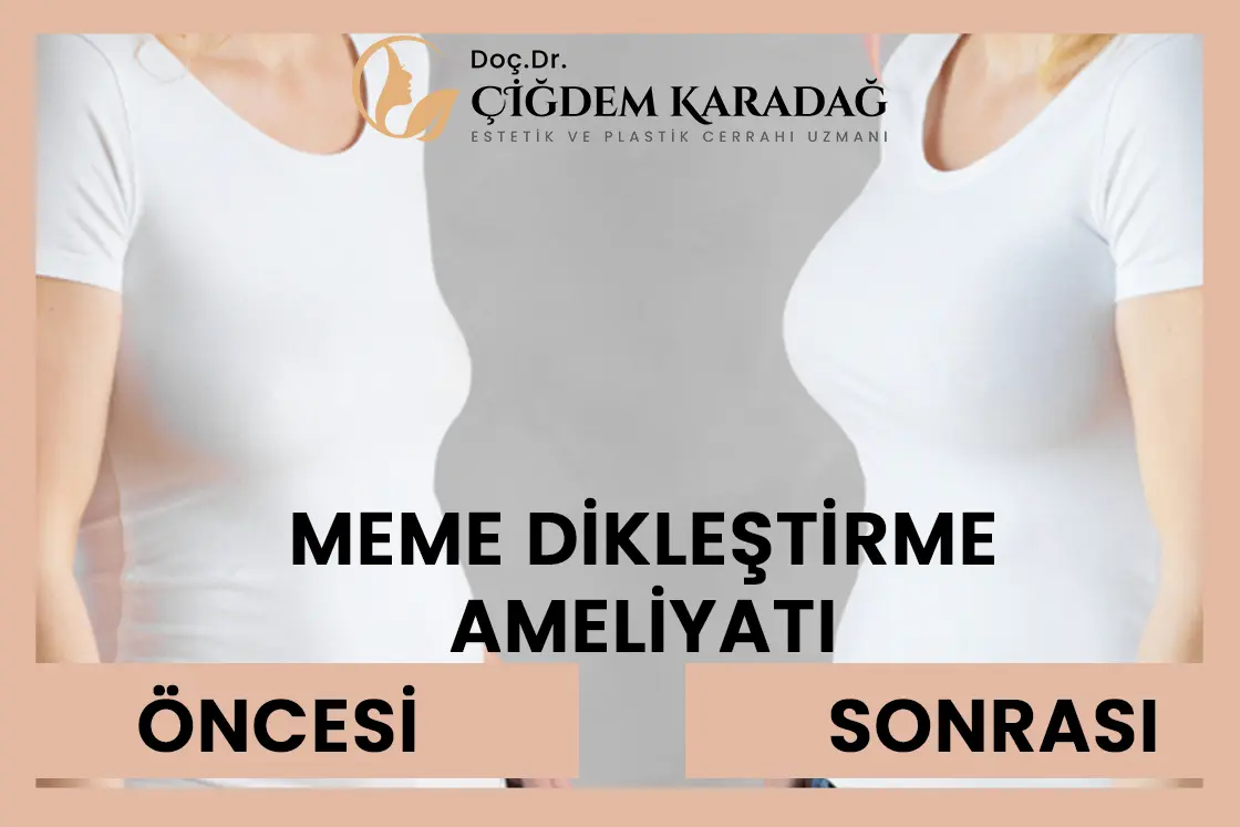 Meme Dikleştirme Ameliyatına İlişkin En Çok Sorulan 10 Soru - Doç. Dr. Çiğdem Karadağ Meme Dikleştirme Ameliyatı, Öncesi - Sonrası