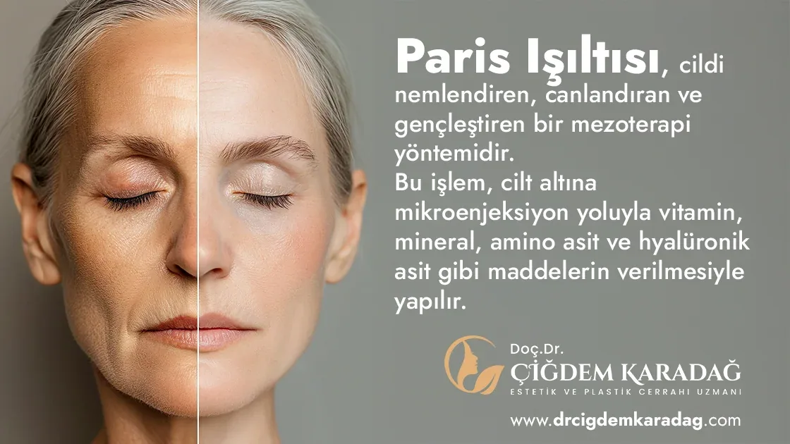 Paris Işıltısı