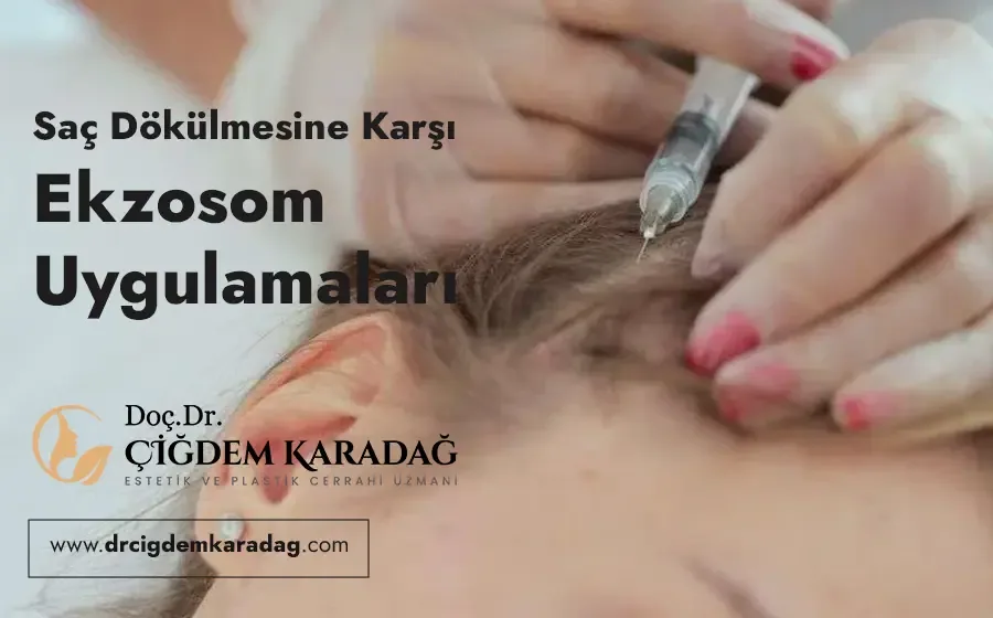 Saç Dökülmesine Karşı Ekzosom Tedavisi
