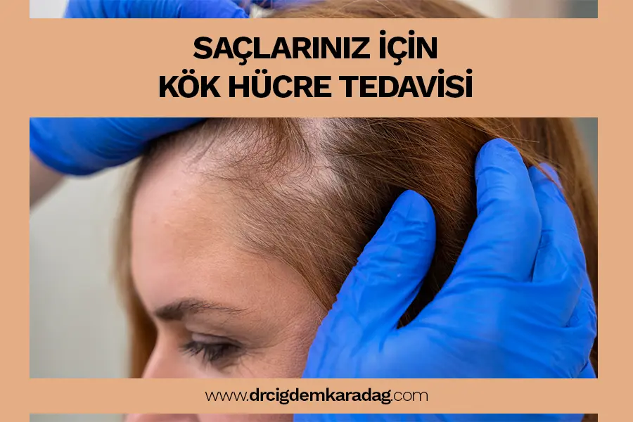 Kök hücre tedavisi ile saçlarınızda yenilenme ve canlılık, 