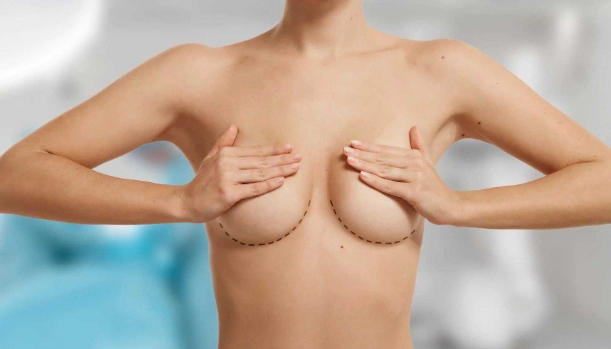 Breast Lift Mastopexy Do . Dr. i dem Karada