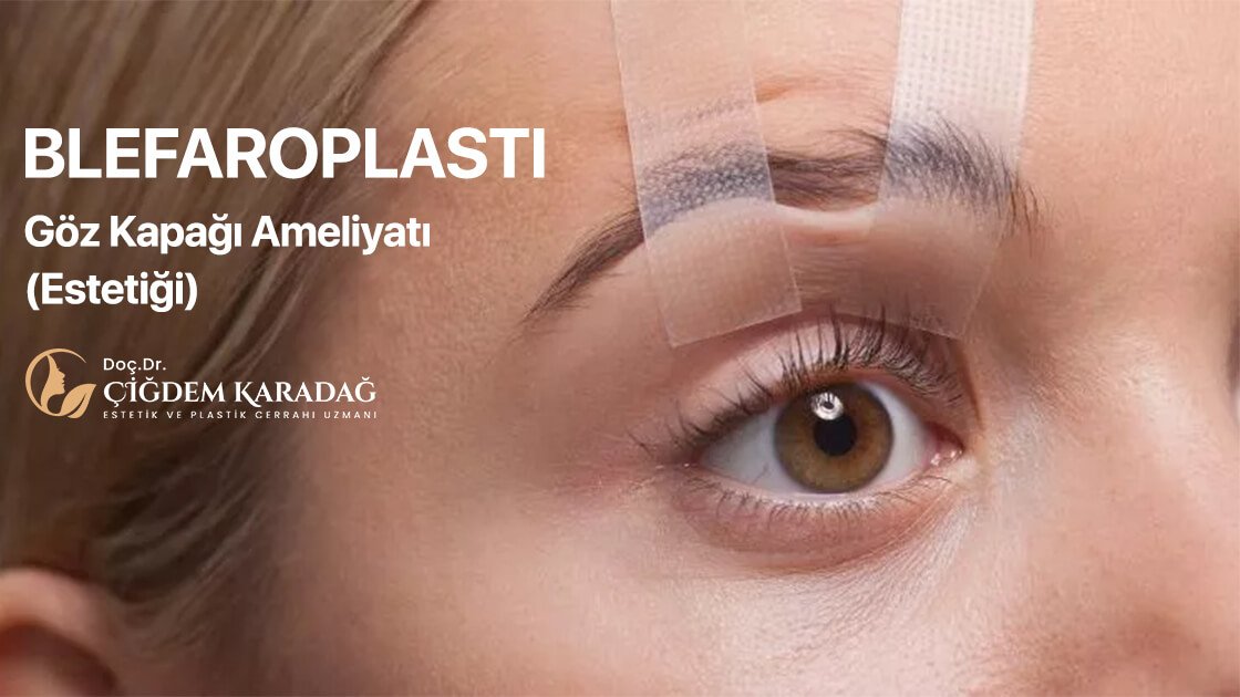 Göz Kapağı Ameliyatı (Estetiği) | İstanbul