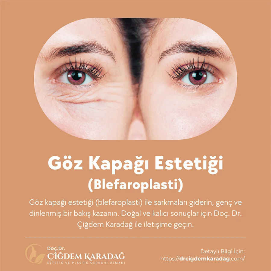 Göz Kapağı Estetiği (Blefaroplasti) - Doç. Dr. Çiğdem Karadağ