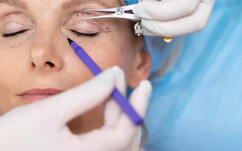 Göz kapağı hakkında bilmeniz gerekenler