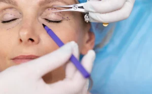 Göz kapağı hakkında bilmeniz gerekenler