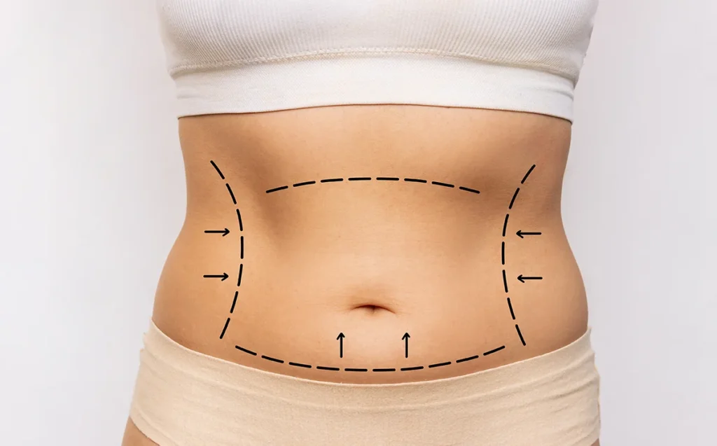 360 Derece Karın Germe